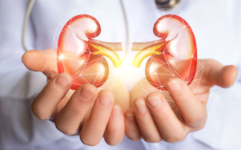 A Q&A Guide to Kidney Stones