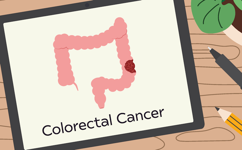 Get the Facts and Stats About Colorectal Cancer