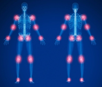 Blog Post Image