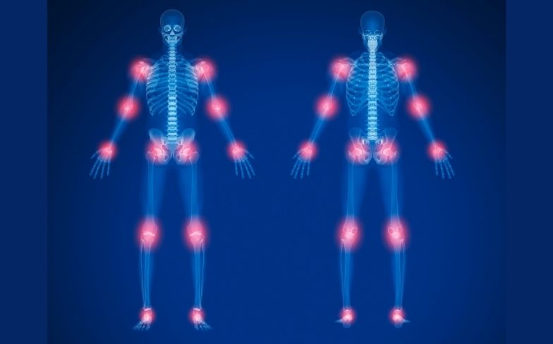 Common Orthopedic Conditions You Should Know