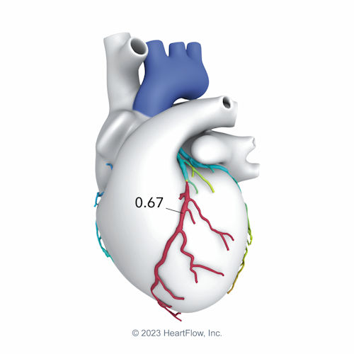 A graphic image of a heart
