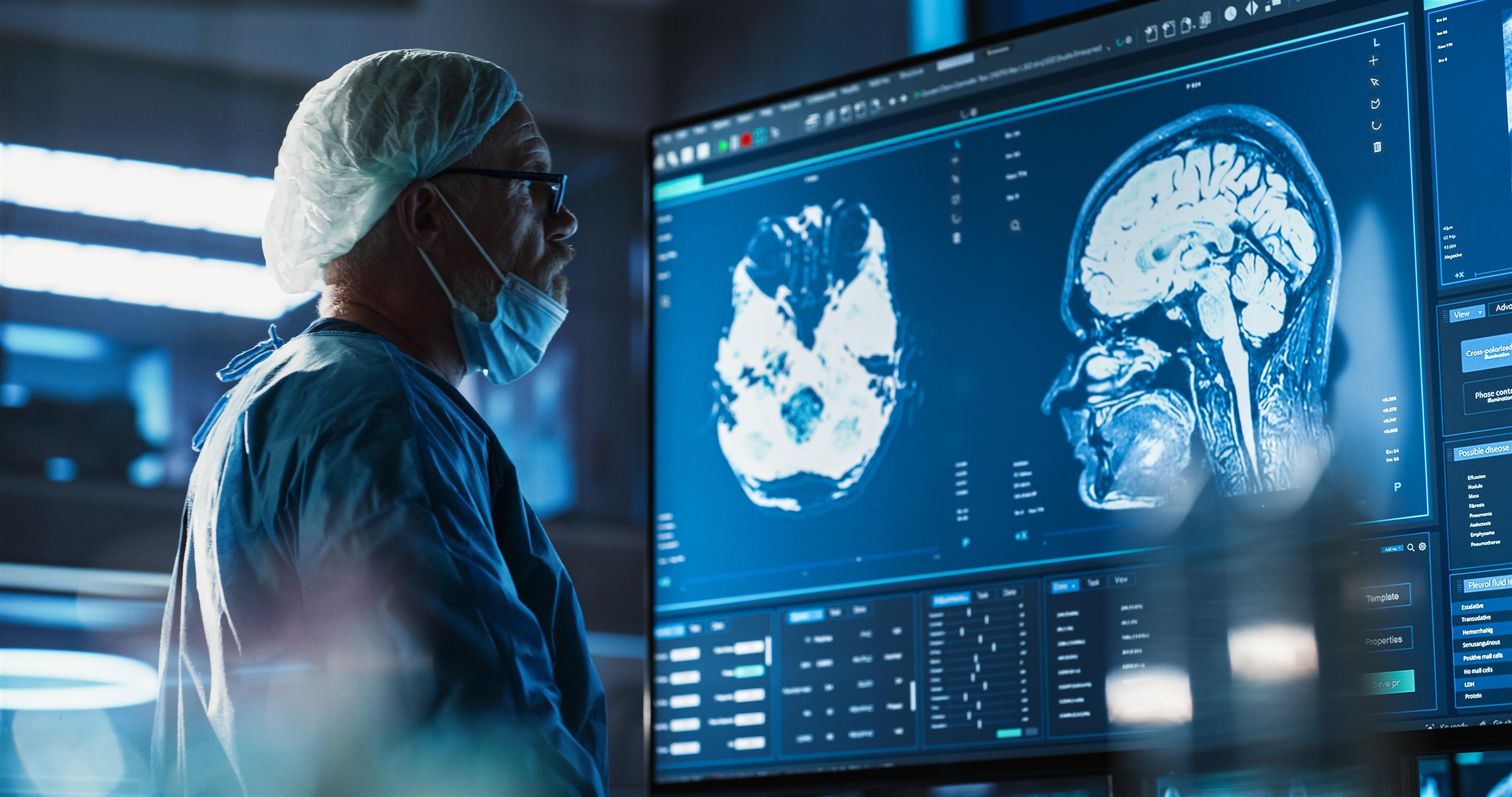 Doctor looking at brain scan